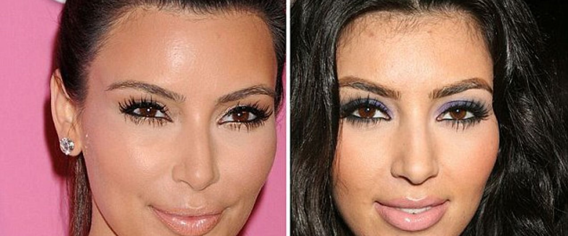 The Kardashian's Secret to Permanent Hair Removal