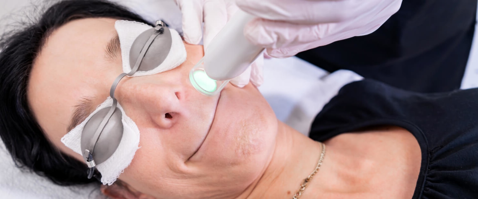 Can Laser Hair Removal Permanently Remove Upper Lip Hair?