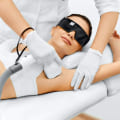 How Much Does Laser Hair Removal Cost for a Small Area? - An Expert's Guide