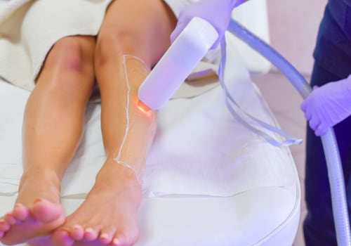 Everything You Need to Know About Laser Hair Removal Discounts