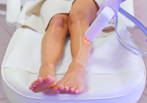 Is Full Leg Laser Hair Removal Worth It? - A Comprehensive Guide