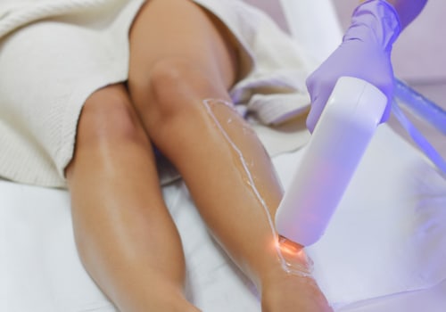 The Dangers of Excessive Laser Hair Removal: What You Need to Know