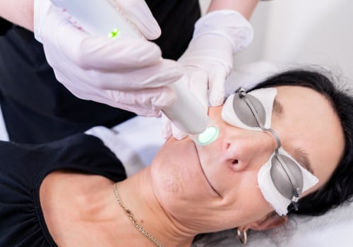 What is the Cost of Laser Hair Removal for a Chin Wax?